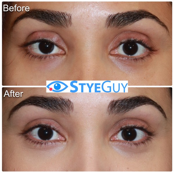 Before and After Image Stye at StyeGuy in River Edge, New Jersey.