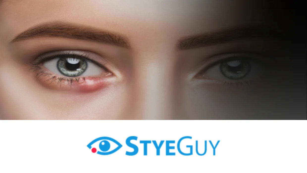 Stye Guy OG Image